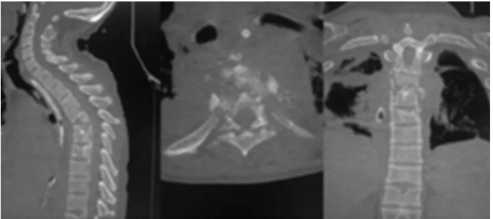 Fig. 2 – CT scans in the sagittal, axial and coronal sections.