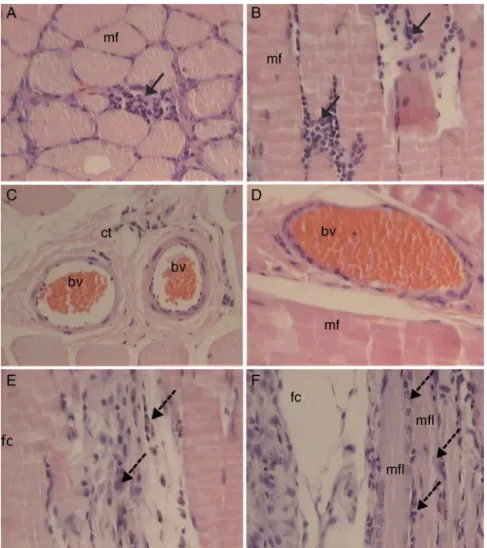 Fig. 5 – Photomicrograph of rats treated with PRP after 7 days. An inflammatory process due to mononuclear cells (continuous arrows), muscle fiber in transverse section (mf), muscle fiber in longitudinal section (mfl), myotubes (dashed arrows), blood vesse