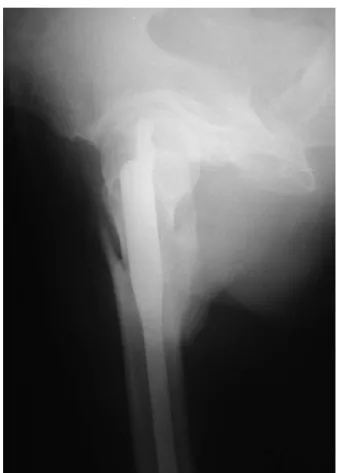 Fig. 7 – AP radiograph of the pelvis during the immediate postoperative period.