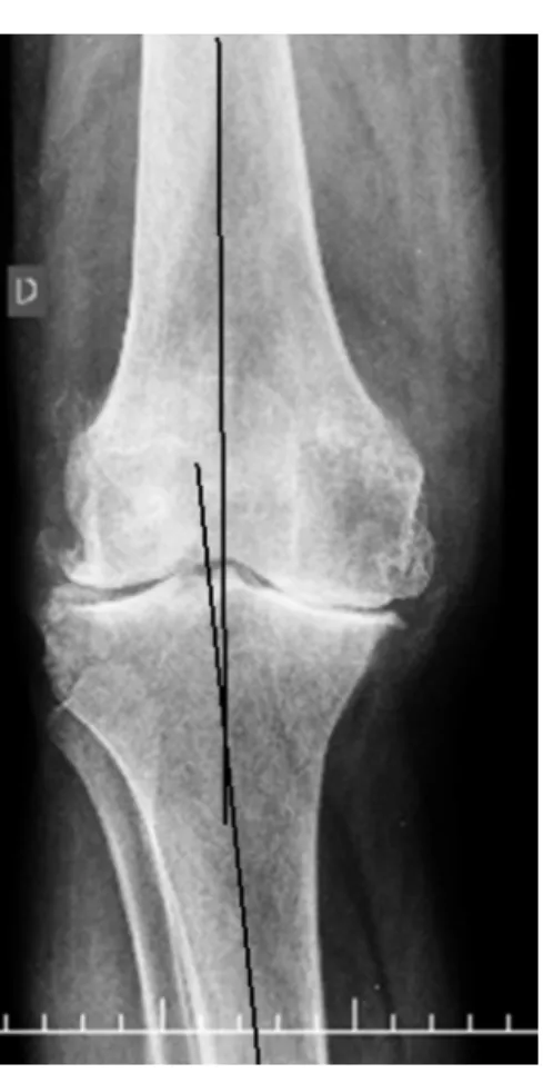 Fig. 1 – Panoramic radiograph of the lower limb.