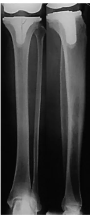Fig. 1 – Radiographs in anteroposterior view.