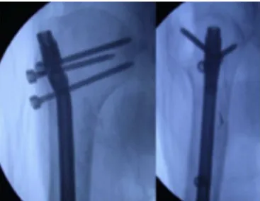 Fig. 6 – Image demonstrating evaluation on the left shoulder 12 months after the treatment.