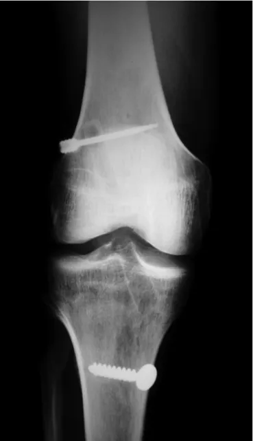 Table 2 – Factors relating to the injury.
