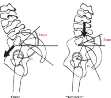 Fig. 3 – Shear and nutcracker types.
