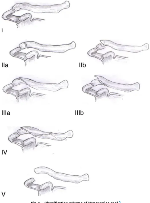 Fig. 1 – Classification scheme of Nenopoulos et al. 5