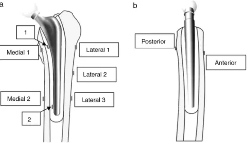 Fig. 2 – Extensometers, represented by small gray boxes. The extensometers embedded in positions 1 and 2 were laid out respectively at distances of 130 mm and 20 mm from the tip of the stem (a)