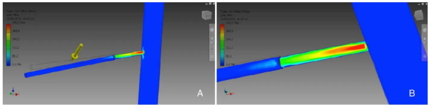 Fig. 3 – Graphical representation of the areas of stress concentration (A) and illustration of the deformation (B) in the M1 Schanz screw