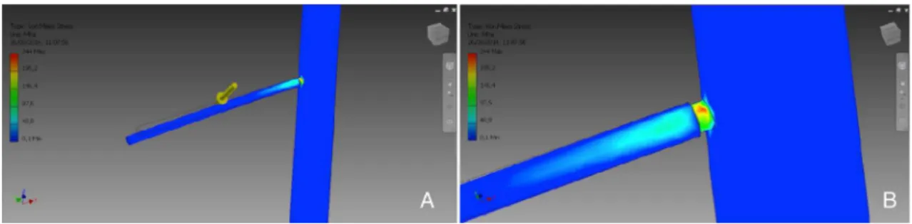 Fig. 4 – Graphical representation of the areas of stress concentration (A) and illustration of the deformation (B) in the Schanz screw in mounting 2