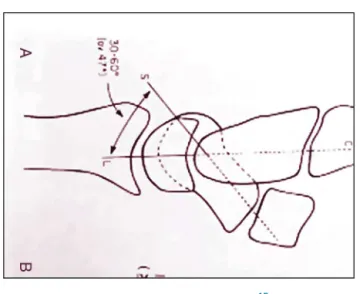 Fig. 5 – Schematic drawing. 15