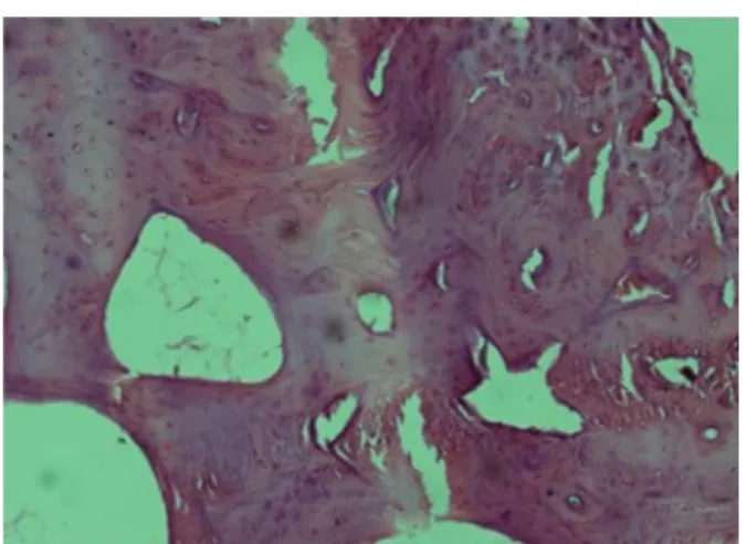 Fig. 9 – Histological slide of the control group at 16 weeks showing bone formation and fibrosis.