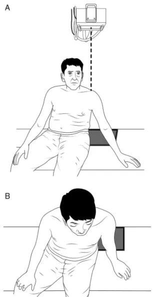 Fig. 1 – Schematic illustration representing the frontal (A) and superior view (B) of the patient and the chassis positioning, as well as the incidence angle of X-rays for the modified axillary radiograph.