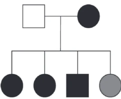 Figure 1: Heredogram exhibiting four of six members affected with both posterior embryotoxon and corneal central guttata or Fuchs distrophy (black) and, one member affected only with anterior segment alterations (gray).