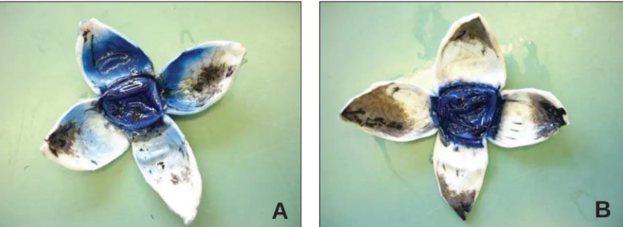 Figure 1: Stained trypan blue porcine eye. A: after thalamosinusotomy ab interno procedure; B: after sham surgery