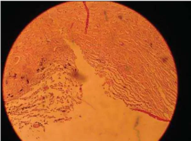 Figure 2: Histology of the thalamosinusotomy incision (the incision reached the scleral layer of the porcine eyes through their trabecular meshwork).