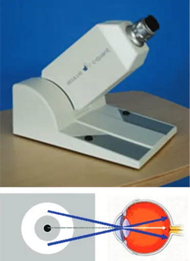 Figure 3: Scheimpflug images and classification of lens densitometry