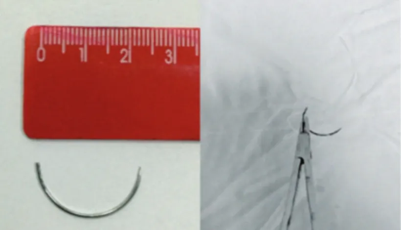 Figure 1: Surgical needle with silicone rod threaded through