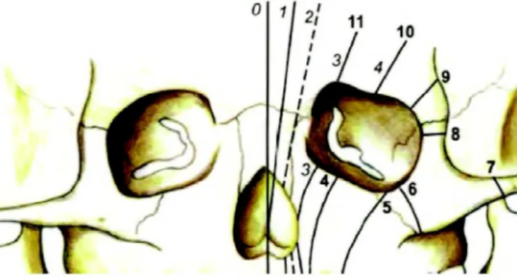 Figure 2:  Oro-ocular clefts and the Tessier’s classification.