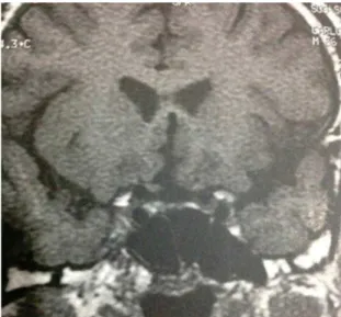 Figure 3: MRI - sagittal section.