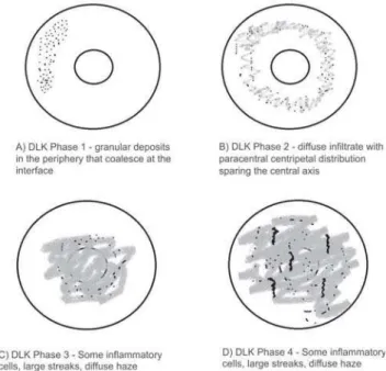 Figure 1: Classification of DLK