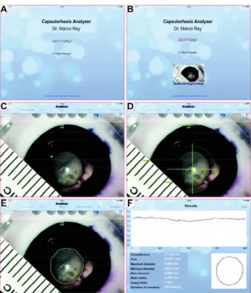 Figure  2:  A  - Application  start  screen.  B  -  Capture  of  the  image chosen. C and D - Centralization and calibration of the application by the ruler photographed during the experiment