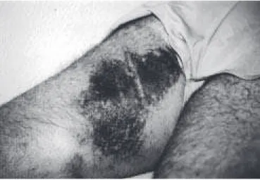 Fig. 1 Fig. 2