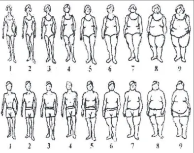 Fig. 1 – Set of profiles proposed by Stunkard  et al . (29)