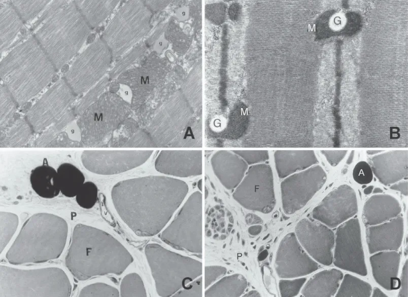 Fig. 1 – Micrographs of the soleus muscle (A and B) – Observe several lipid droplets surrounded by mitochondrias (M) – given by Aoki (2000) (31) 