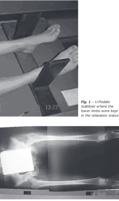 Fig. 1 – U-Podalic stabilizer w here the low er limbs w ere kept in the relaxation status