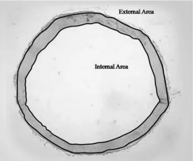 Figure 1. Illustration of the measurement of the tunica media area of the left com- com-mon carotid artery wall, horizontal aorta and thoracic with aid of the Scion Image  software for Windows