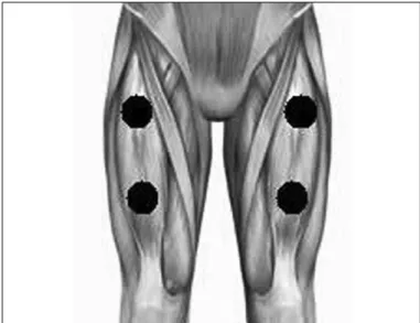 Figure 1. Point used in the LEDT application (active or placebo).