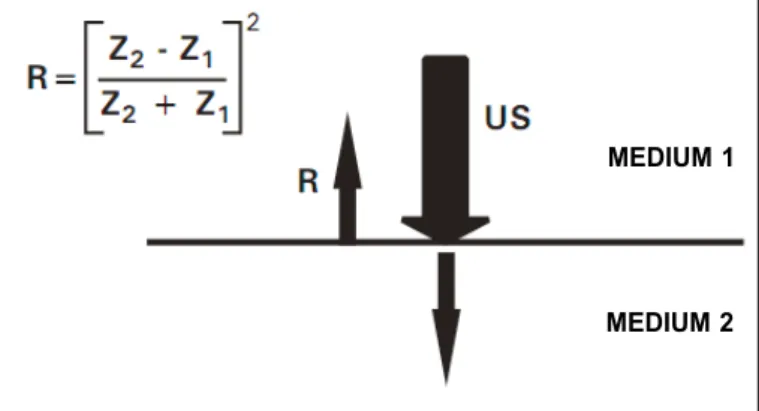 Figure 1. Refraction of the ultrasound waves in biological tissue.