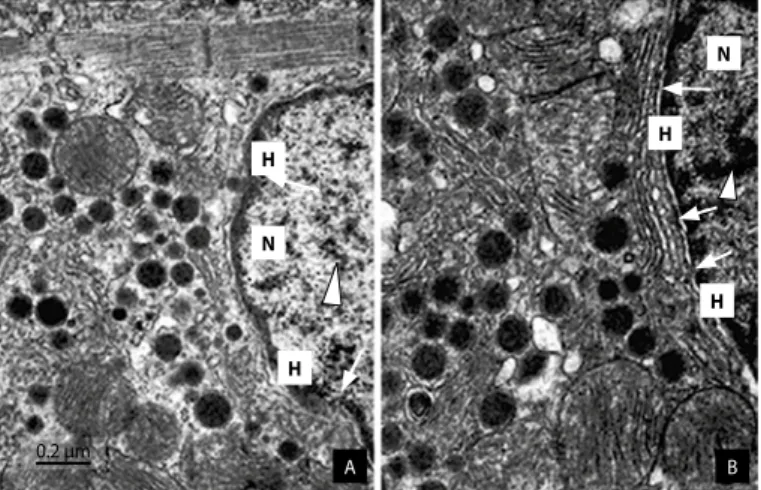 Figure 4. Electronic photomicrographs of sections obtained from right atrium car- car-diomyocytes from the CG (A) and TG (B) mice showing the nucleus (N) with  euchro-matin (arrow heads) and the pores of nuclear membrane (arrows)