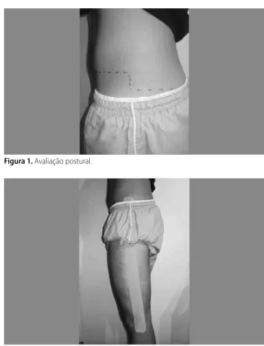 Figura 1. Avaliação postural.