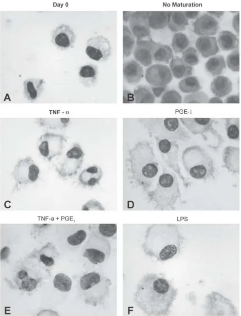 Figure 2. Morphological changes after culturing monocyte cells with GM-CSF plus IL-4 and in the presence or absence of different maturation stimuli