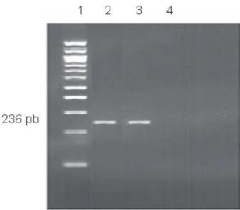 Figura 1. Resultado da amplificação por PCR-Nested de Aspergillus.