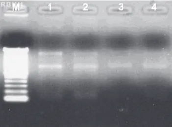 Figure 1. Relationship between 28S/18S ribosomal RNA bands using 1.2% denaturing agarose gel