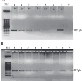 Figure 1 - GYPB*S and GYPB*s genotyping - 2% agarose Gel.