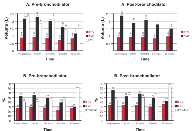 Figure 1 - Spirometric values achieved by Patient 2; A) Forced expiratory volume in 1 second (FEV1), Forced vital capacity (FVC)  and vital capacity (VC); B) Percentages predicted for FEV1, FVC and the FEV1/FVC ratio; pre- and post-bronchodilator values