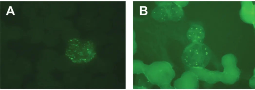 Figure 1 - Photomicrographs of the immunoluorescence staining test using the anti-PML antibody showing: 