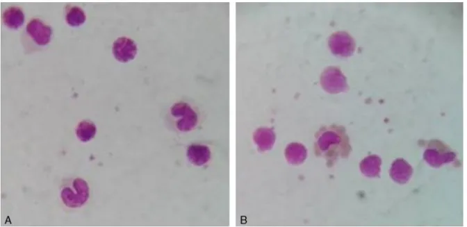 Figure 2 – Monocyte monolayer assay slides (1000×). (A) Negative control and (B) Monocyte monolayer assay with anti-Wr a .
