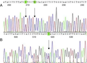 Figure 1 – Sequencing four-color chromatogram showing (A) IVS-II-844 (C>A) and IVS-II-839 (T>C) mutations in cis ; and (B) the −92 (C>T) mutation.
