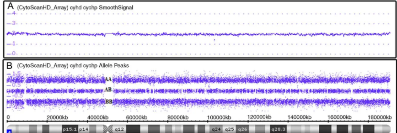 Figure 1 – Affymetrix ® Chromosome Analysis Suite image showing normal chromosome 4. (A) Smooth signal representing a normal copy number (purple line CN: 2.00)