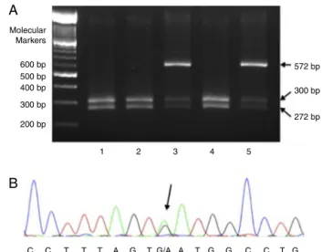 Figure 1 – Molecular detection of mutations in Hb D-Punjab and Hb Korle Bu. (A) Polymerase chain reaction-restriction fragment length polymorphism with EcoRI in five children with Hb D-Punjab