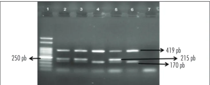 Figure 1. Electrophoresis of  GSTP1 ,  GSTM1  and  GSTT1 . Identiied frag- frag-ments were: 170, 215 and 419 bp of  GSTP1 ,  GSTM1  and  GSTT1  genes, respectively