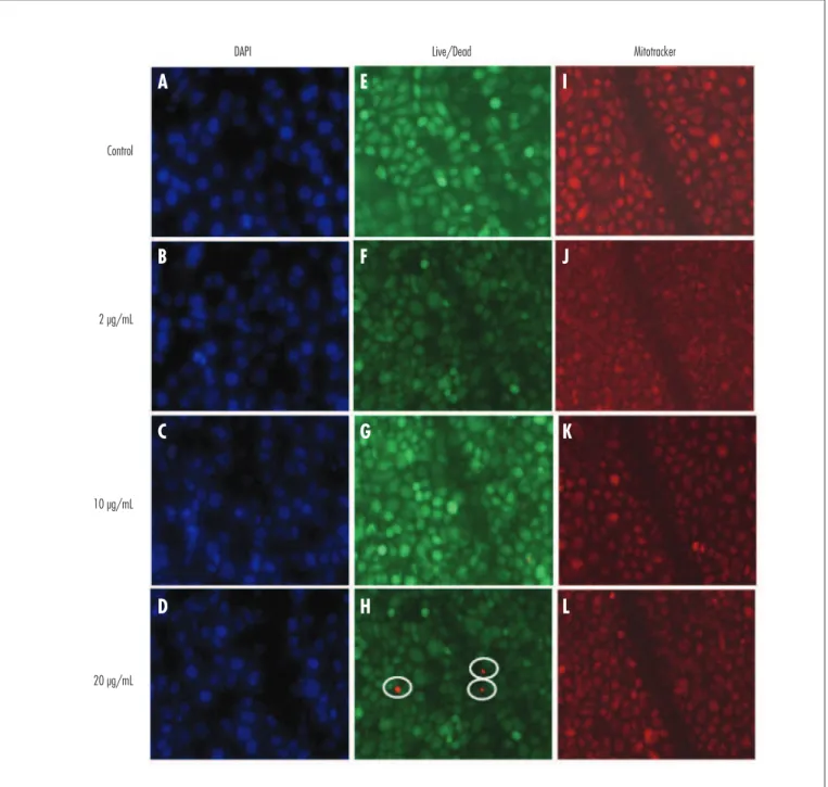 Figure 4. Representative images of DAPI (A to D), Live/Dead (E to H) and MitoTracker (I to L) staining of TOV-21 G cells treated with 2, 10 and 20 µg/mL of ibuprofen