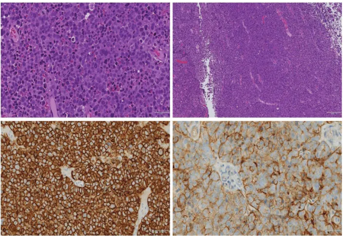 Fig. 1 Histological study of fragments of the endometrium. (A and B) Hematoxylin-eosin (HE)
