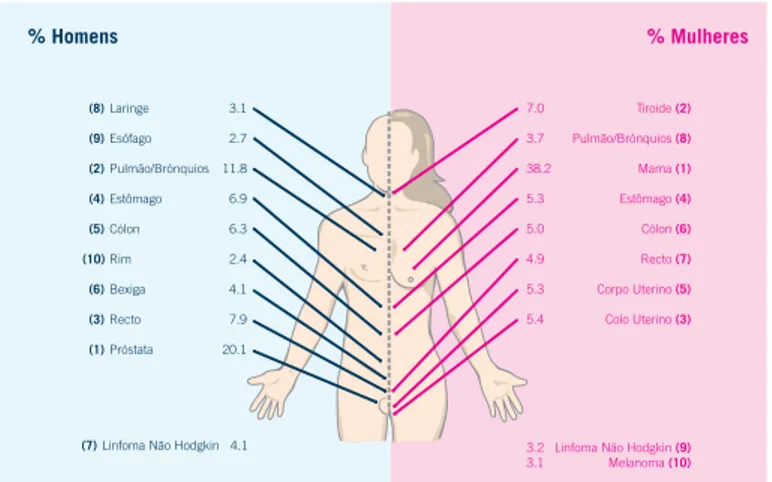 Figura 1 – Tumores mais frequentes no sexo masculino e feminino no ano de 2008  (Registo Oncológico Regional 2008, IPO Porto)