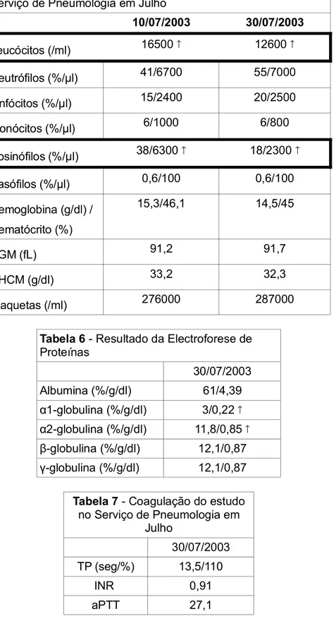 Tabela 5 - Hemograma do episódio de urgência e estudo no Serviço de Pneumologia em Julho