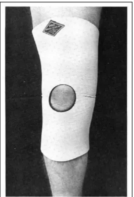 Figura 12- “Knee Sleeve” (Adaptado de (18)).