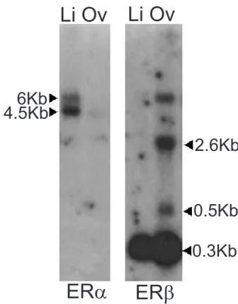 Figure 5 Northern blot analysis of seabream ER and ER. Liver (Li) and ovary (Ov) poly(A) + mRNA (5 g) were probed with a 341 bp cDNA fragment encoding sbER and full-length sbER.